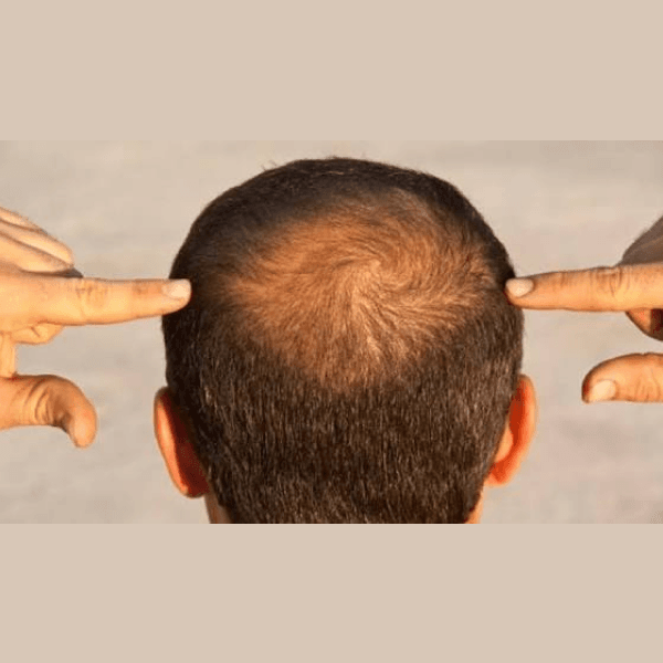 Busra Organic Hair Oil - স্লাইড 3