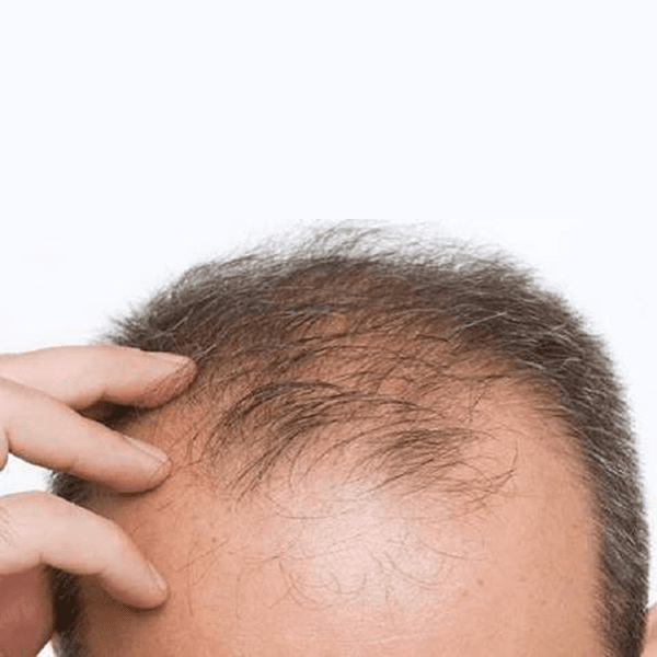 Busra Organic Hair Oil - স্লাইড 1